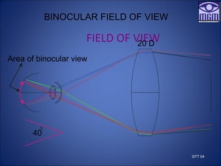 FIELD OF VIEW
20 D
40
Area of binocular view
BINOCULAR FIELD OF VIEW
GTT 04
 
