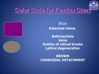 Color Code for Fundus Chart
Blue
Detached retina
Retinoschisis
Veins
Outline of retinal breaks
Lattice degeneration
BROWN
CHOROIDAL DETACHMENT
 