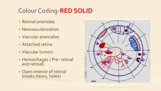 Direct & indirect ophthalmoscopy | PPTX