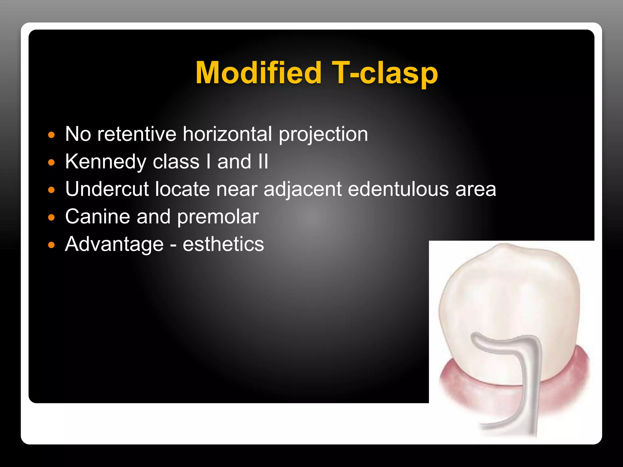 Direct & indirect retainers in rpd | PPTX