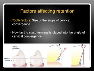 Direct & indirect retainers in rpd | PPTX