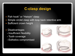 Direct & indirect retainers in rpd | PPTX