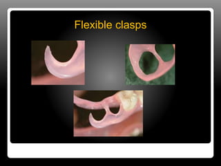 Direct & indirect retainers in rpd | PPTX