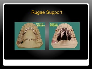 Direct & indirect retainers in rpd | PPTX