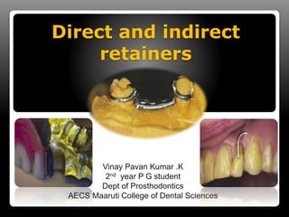 Direct and indirect 
retainers 
Vinay Pavan Kumar .K 
2nd year P G student 
Dept of Prosthodontics 
AECS Maaruti College of Dental Sciences 
 