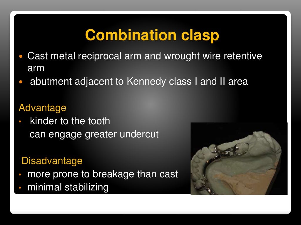 Direct & indirect retainers in rpd