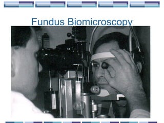 Fundus Biomicroscopy
 