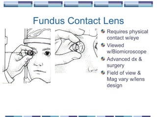 Fundus Contact Lens
Requires physical
contact w/eye
Viewed
w/Biomicroscope
Advanced dx &
surgery
Field of view &
Mag vary w/lens
design
 