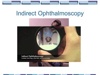 Indirect Ophthalmoscopy
 