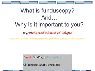 What is funduscopy?
And…
Why is it important to you?
By/Mohamed Ahmed El –Shafie
Assistant Lecturer in ophthalmology department KafrELShiekh University
E-mail: Shaf3y_h@hotmail.com
facebook/shafie eye clinic
 