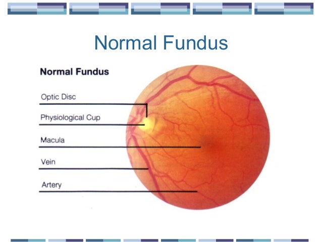The Funduscopic Examination The Funduscopic Examination
