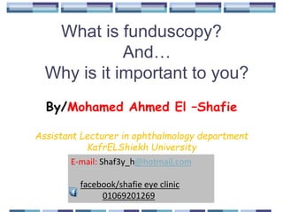 What is funduscopy?
And…
Why is it important to you?
By/Mohamed Ahmed El –Shafie
Assistant Lecturer in ophthalmology department
KafrELShiekh University
E-mail: Shaf3y_h@hotmail.com
facebook/shafie eye clinic
01069201269
 