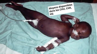 Moyens disponibles
dans les CHU, CHR,
HG
 