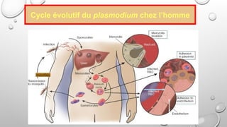 d'après E Bissagnéné (EPU Yamoussoukro
2005)
moustiqu
Cycle évolutif du plasmodium chez l’homme
 