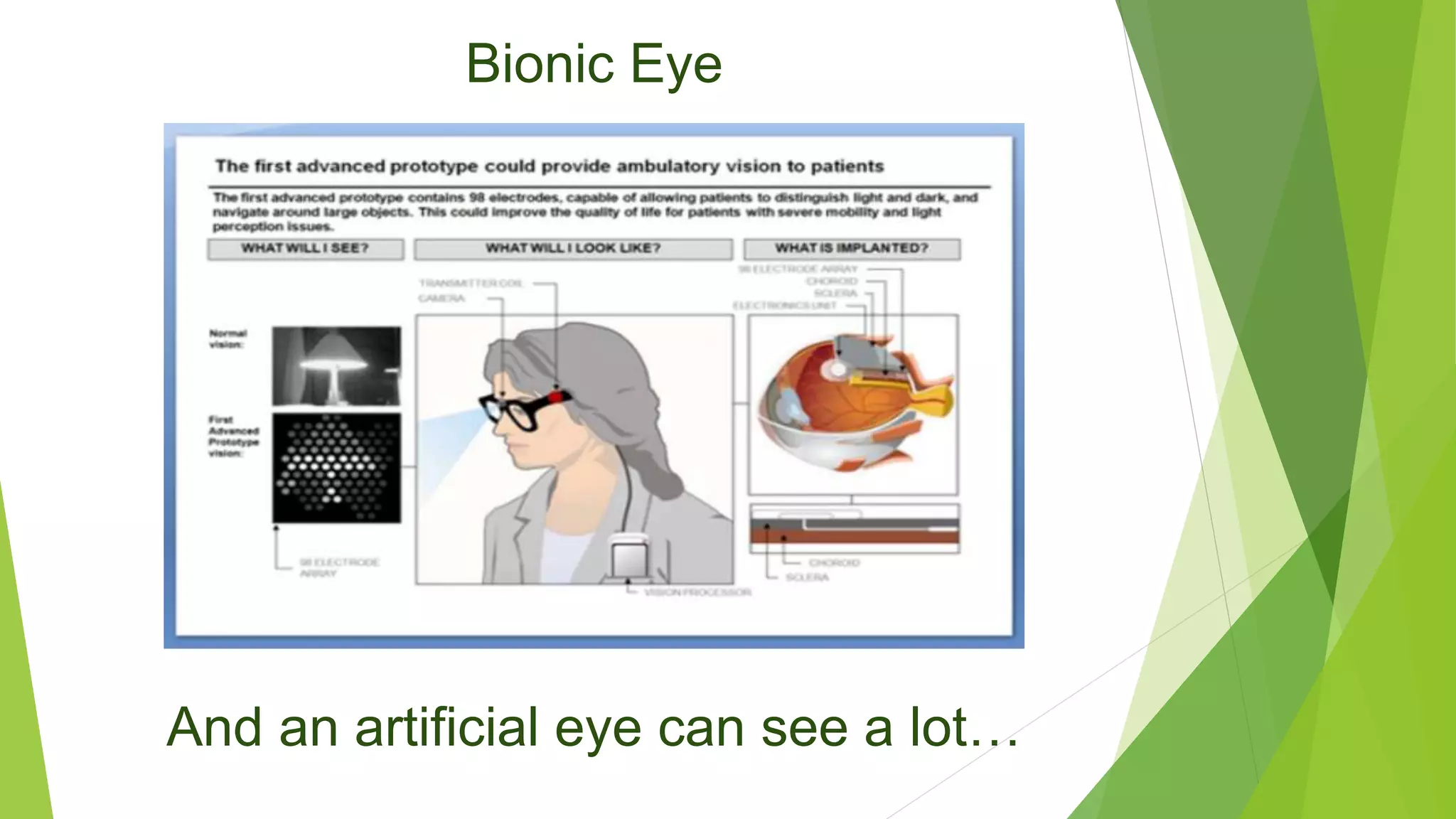 Bionic Eye
And an artificial eye can see a lot…
 