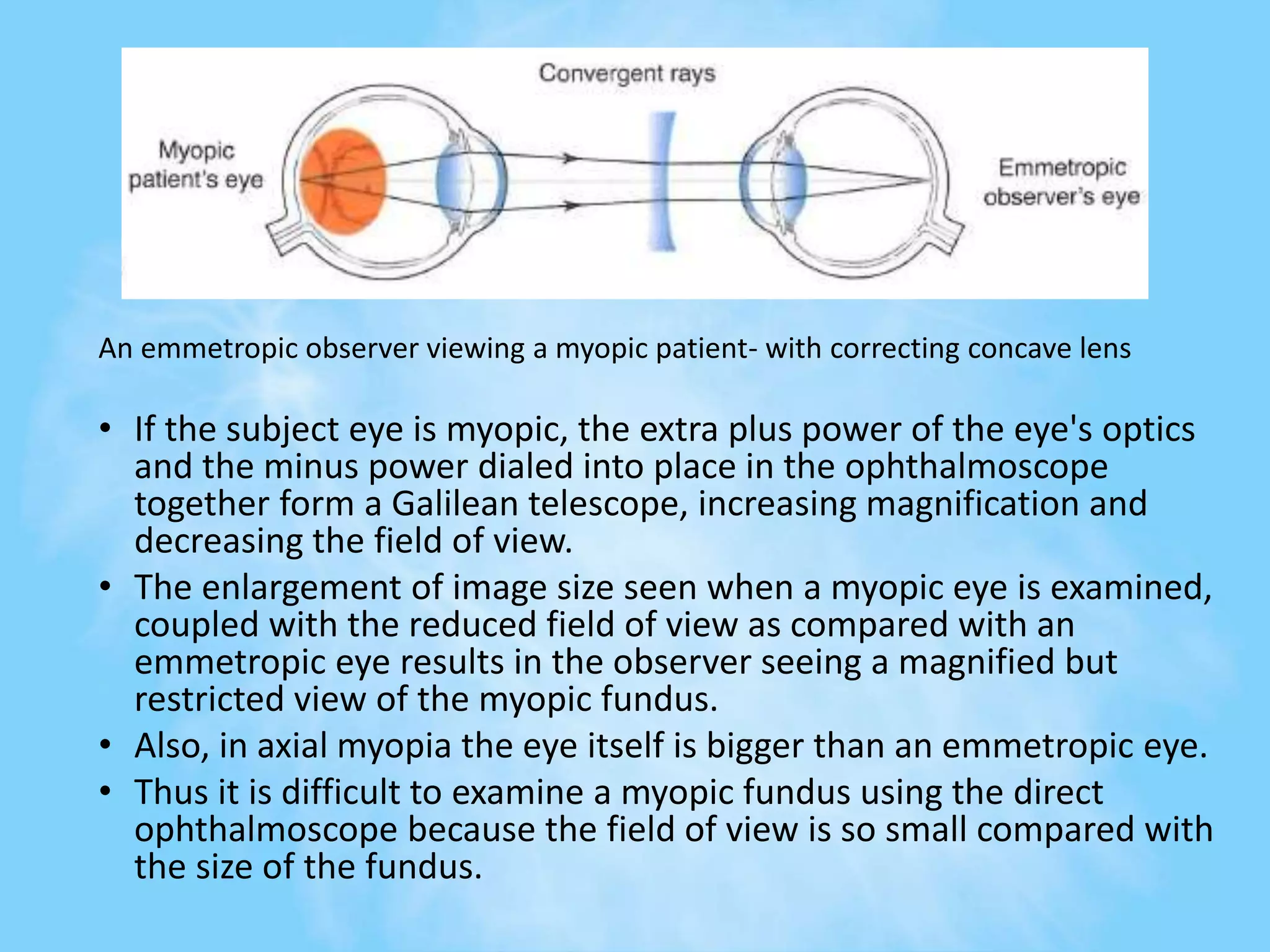Direct ophthalmoscope | PPTX