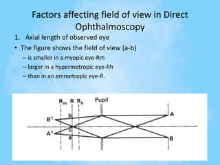 Factors affecting field of view in Direct
Ophthalmoscopy
1. Axial length of observed eye
• The figure shows the field of view (a-b)
– is smaller in a myopic eye-Rm
– larger in a hypermetropic eye-Rh
– than in an emmetropic eye-R.
 