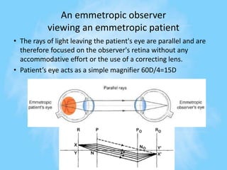 An emmetropic observer
viewing an emmetropic patient
• The rays of light leaving the patient's eye are parallel and are
therefore focused on the observer's retina without any
accommodative effort or the use of a correcting lens.
• Patient’s eye acts as a simple magnifier 60D/4=15D
 