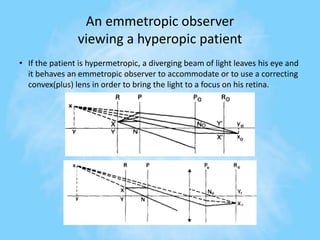 An emmetropic observer
viewing a hyperopic patient
• If the patient is hypermetropic, a diverging beam of light leaves his eye and
it behaves an emmetropic observer to accommodate or to use a correcting
convex(plus) lens in order to bring the light to a focus on his retina.
 