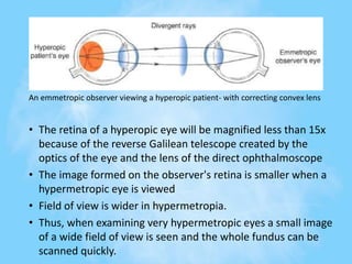 An emmetropic observer viewing a hyperopic patient- with correcting convex lens
• The retina of a hyperopic eye will be magnified less than 15x
because of the reverse Galilean telescope created by the
optics of the eye and the lens of the direct ophthalmoscope
• The image formed on the observer's retina is smaller when a
hypermetropic eye is viewed
• Field of view is wider in hypermetropia.
• Thus, when examining very hypermetropic eyes a small image
of a wide field of view is seen and the whole fundus can be
scanned quickly.
 