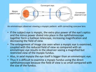 An emmetropic observer viewing a myopic patient- with correcting concave lens
• If the subject eye is myopic, the extra plus power of the eye's optics
and the minus power dialed into place in the ophthalmoscope
together form a Galilean telescope, increasing magnification and
decreasing the field of view.
• The enlargement of image size seen when a myopic eye is examined,
coupled with the reduced field of view as compared with an
emmetropic eye results in the observer seeing a magnified but
restricted view of the myopic fundus.
• Also, in axial myopia the eye itself is bigger than an emmetropic eye.
• Thus it is difficult to examine a myopic fundus using the direct
ophthalmoscope because the field of view is so small compared with
the size of the fundus.
 