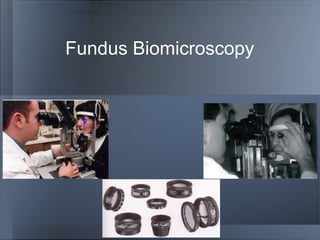 Fundus Biomicroscopy
 