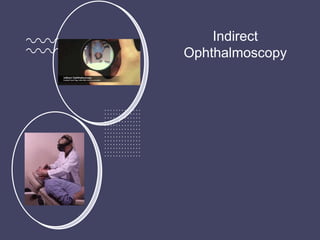 Indirect
Ophthalmoscopy
 