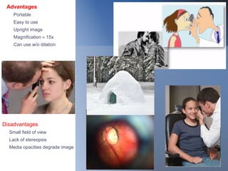 Advantages
Portable
Easy to use
Upright image
Magnification  15x
Can use w/o dilation
Disadvantages
Small field of view
Lack of stereopsis
Media opacities degrade image
 