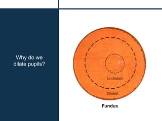 Why do we
dilate pupils?
 