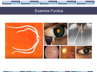 Examine Fundus
 