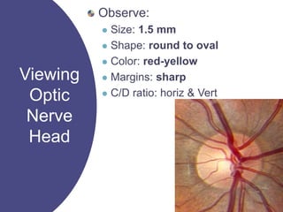 Viewing
Optic
Nerve
Head
Observe:
 Size: 1.5 mm
 Shape: round to oval
 Color: red-yellow
 Margins: sharp
 C/D ratio: horiz & Vert
 