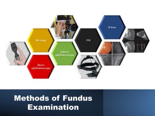 Methods of Fundus
Examination
 