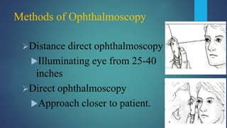 Methods of Ophthalmoscopy
Distance direct ophthalmoscopy
Illuminating eye from 25-40
inches
Direct ophthalmoscopy
Approach closer to patient.
 