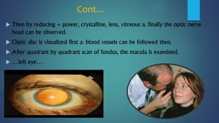 Cont…
 Then by reducing + power, crystalline, lens, vitreous & finally the optic nerve
head can be observed.
 Optic disc is visualized first & blood vessels can be followed then.
 After quadrant by quadrant scan of fundus, the macula is examined.
 …left eye…
 