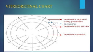 VITREORETINAL CHART
 