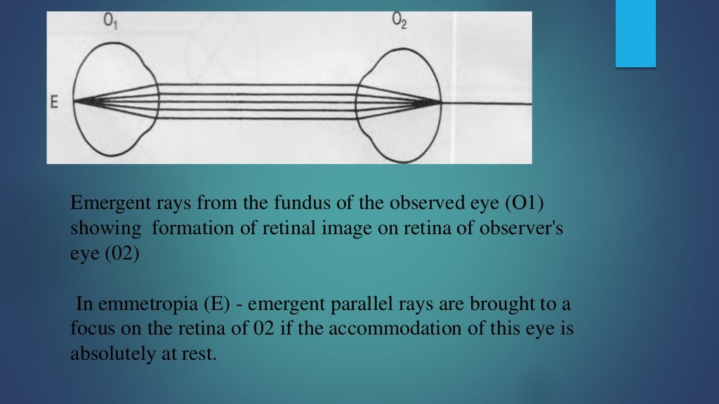 Direct ophthalmoscopy final