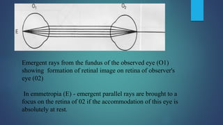 Emergent rays from the fundus of the observed eye (O1)
showing formation of retinal image on retina of observer's
eye (02)
In emmetropia (E) - emergent parallel rays are brought to a
focus on the retina of 02 if the accommodation of this eye is
absolutely at rest.
 