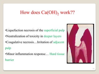 Direct pulp capping | PDF