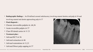 Direct pulp capping with PRF idm topic.pptx