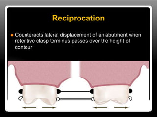 Reciprocal Tooth direct retainer in Cast partial Dentures.pptx