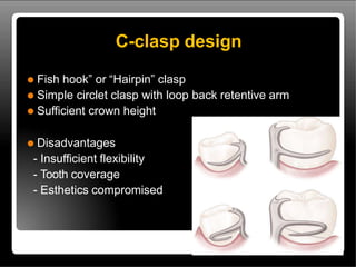 direct retainer in Cast partial Dentures.pptx