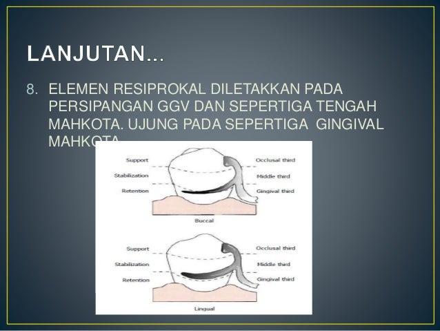 Direct retainers