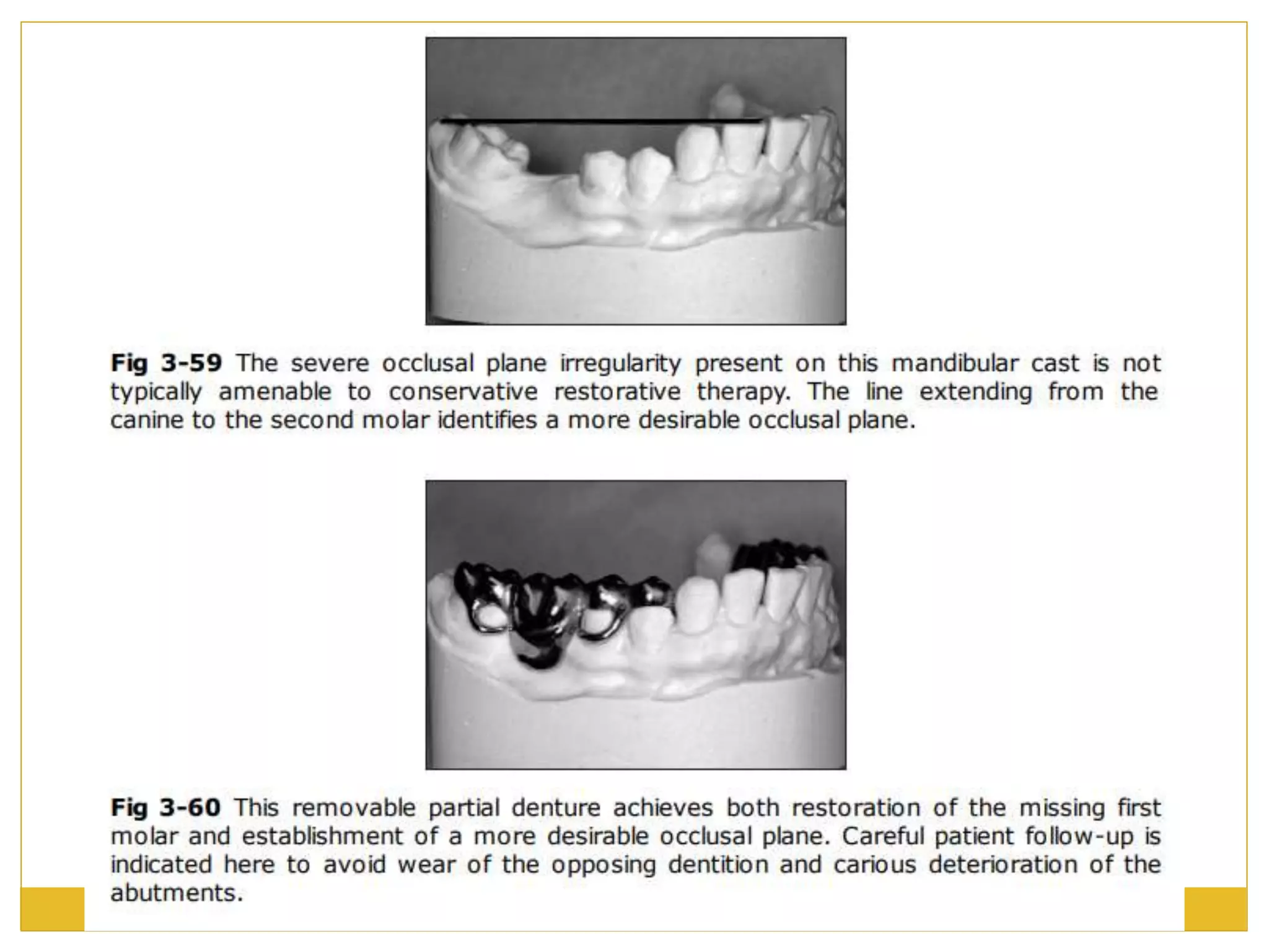 Direct retainers | PPTX