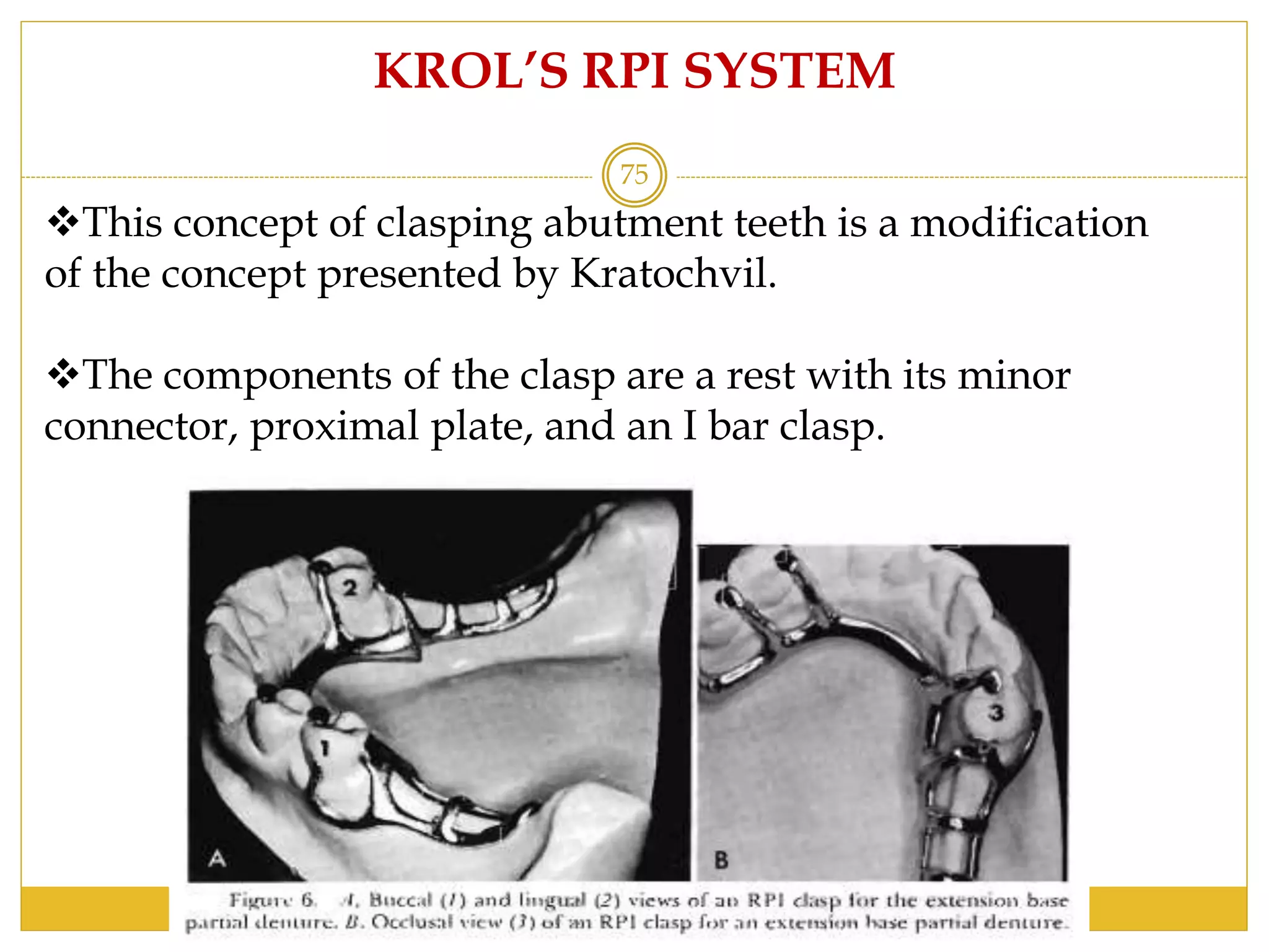 Krol Rpi Design Direct retainers | PPTX