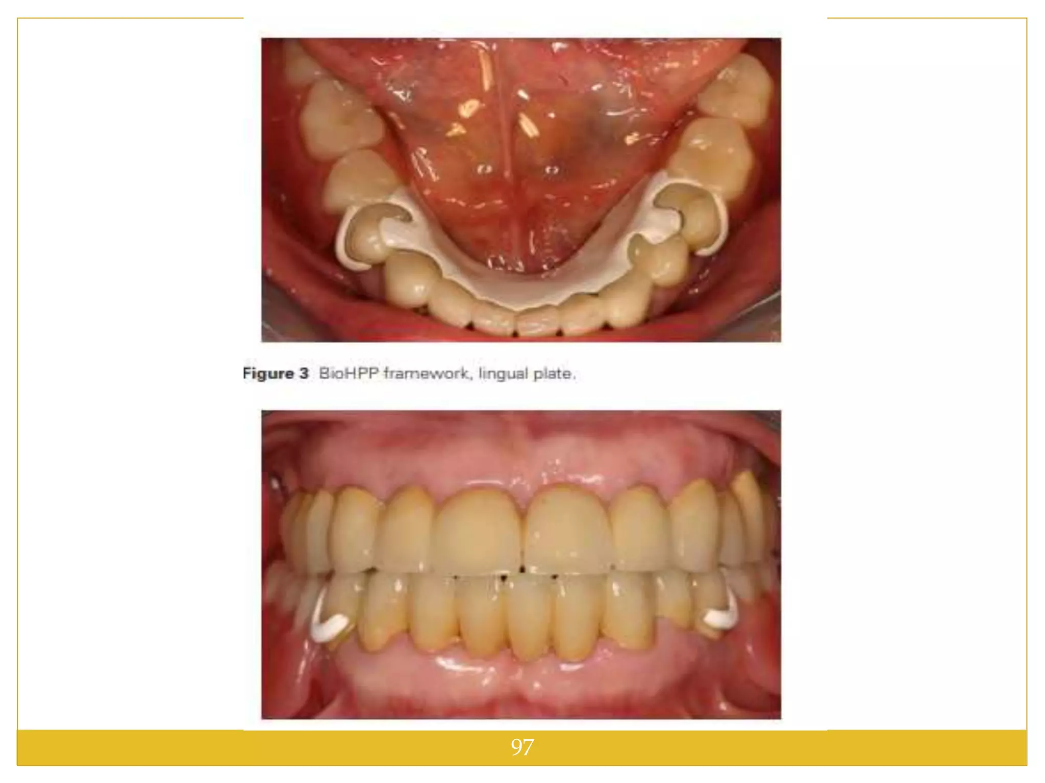 Direct retainers | PPTX