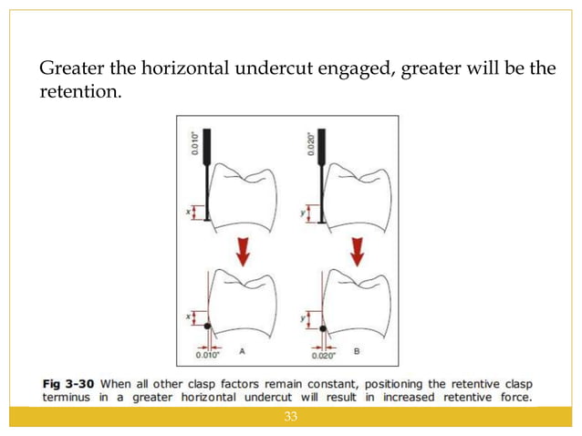 Direct retainers | PPTX