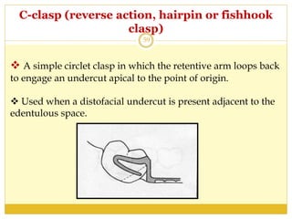  A simple circlet clasp in which the retentive arm loops back
to engage an undercut apical to the point of origin.
 Used when a distofacial undercut is present adjacent to the
edentulous space.
C-clasp (reverse action, hairpin or fishhook
clasp)
59
 