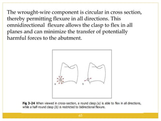 The wrought-wire component is circular in cross section,
thereby permitting flexure in all directions. This
omnidirectional flexure allows the clasp to flex in all
planes and can minimize the transfer of potentially
harmful forces to the abutment.
65
 