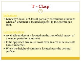 T – Clasp
Indications :
 Kennedy Class I or Class II partially edentulous situations
when an undercut is located adjacent to the edentulous
area.
Contraindication :
 Available undercut is located on the mesiofacial aspect of
the most posterior abutment.
 If the approach arm must cross over an area of severe soft
tissue undercut.
 When the height of contour is located near the occlusal
surface.
70
 