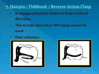 DIRECT RETAINERS.ppt